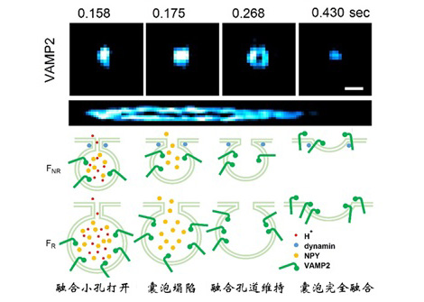 中国学者Nature Biotechnology：一种超灵敏结构光超高分辨率显微镜