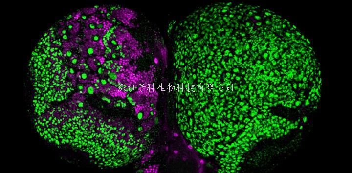 北大学者eLife发文：神经祖细胞命运锁定，防止脑肿瘤发生新机制