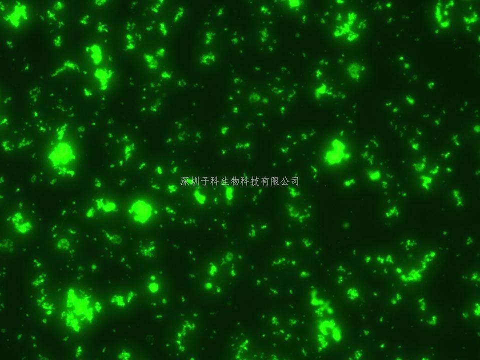 重庆大学Nature子刊发表耐药研究首发性成果