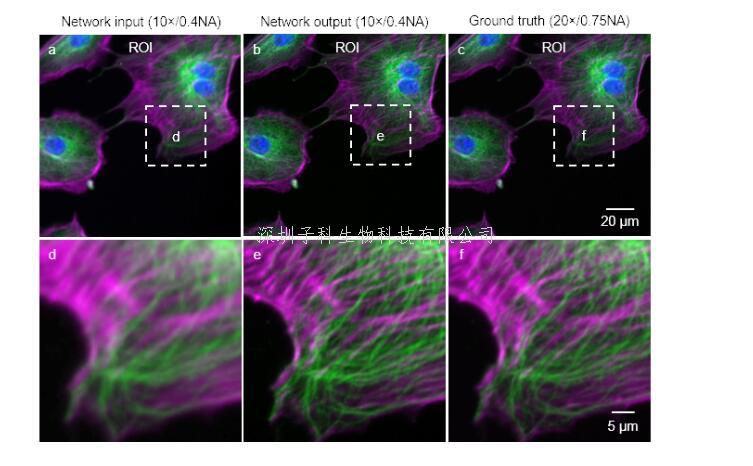 Nature Methods“修图”技术遭质疑：低分辨率变成高分辨率