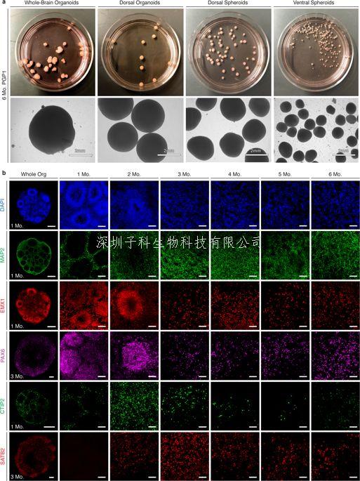 可复制的微型人脑3D模型开辟神经科学新领域