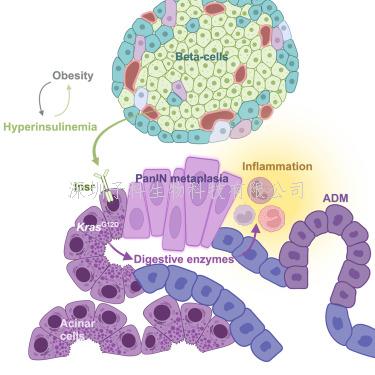 Cell子刊：首次指出胰腺腺泡细胞与胰岛素水平升高有关